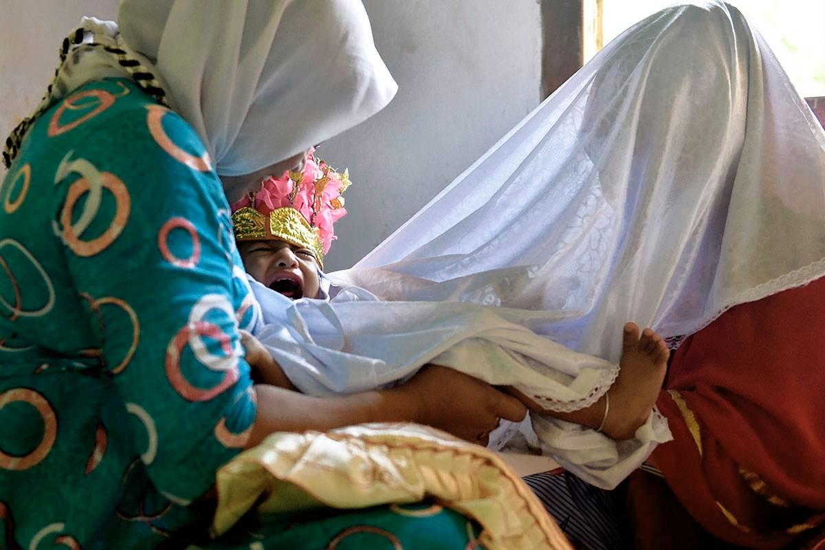 Indonesialainen tyttö kärsii silpomisen aiheuttamasta kivusta helmikuussa 2017. Toimenpide aiheuttaa naiselle pysyvän psyykkisen trauman.