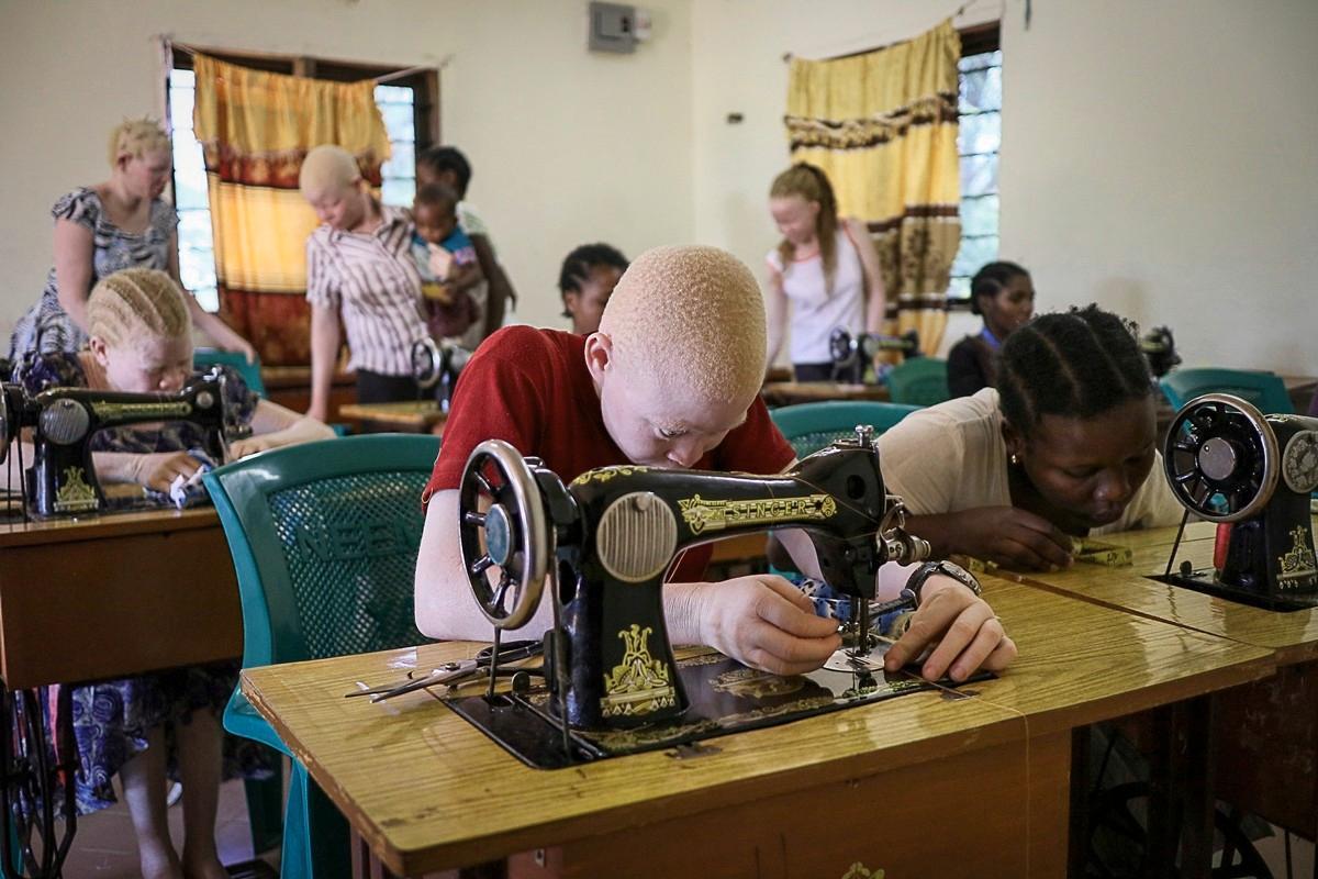 Kirkko opettaa albinistisia tyttöjä ompelemaan. Näin he voivat saada arvostetun ammatin.