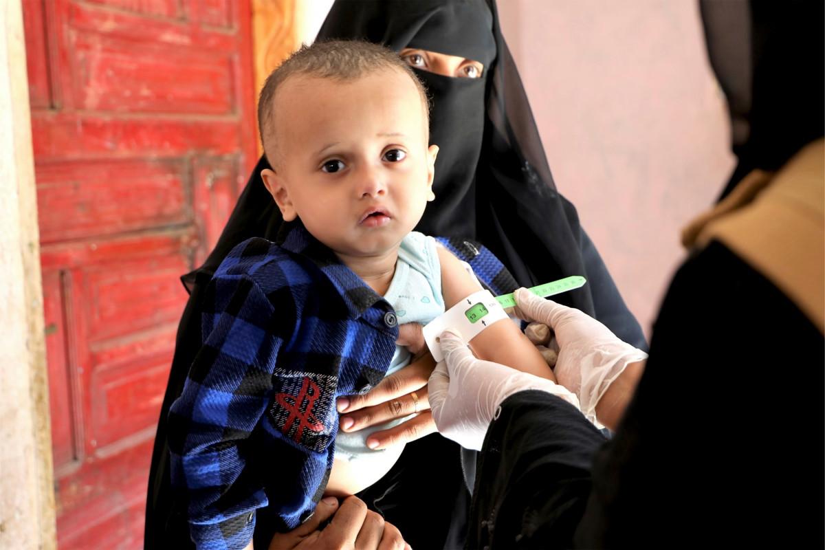Vakavasta aliravitsemuksesta kärsivä 15-kuukautta vanha Amin (nimi muutettu) äitinsä kanssa Pelastakaa Lasten tukemalla terveysklinikalla Taizin kaupungissa Jemenissä. Poikaa hoidettiin energiapitoisella ravintolisällä ja hän on nyt toipunut. Perhe kamppailee toimeentulonsa kanssa ja ruoan saanti on jatkuva haaste.   Kuva: Hadil Saleh / Pelastakaa Lapset