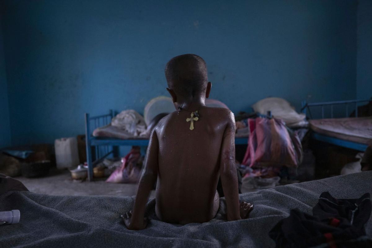 Micheale Gebremariam istuu sängyllään pakolaisleirillä Hamdayetissa Sudanissa.