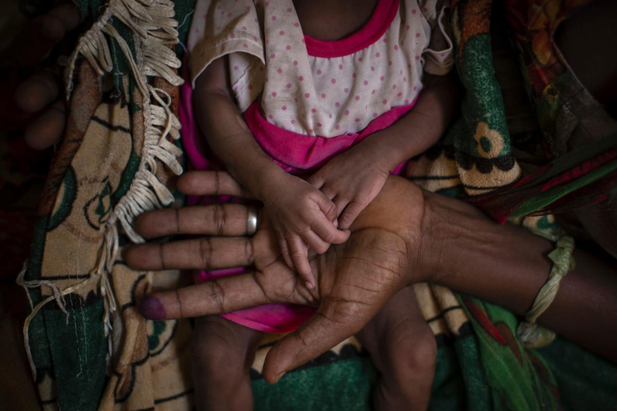 Äiti pitelee aliravitun tyttärensä käsiä terveysklinikalla Abi Adin kaupungissa Tigrayn alueella.